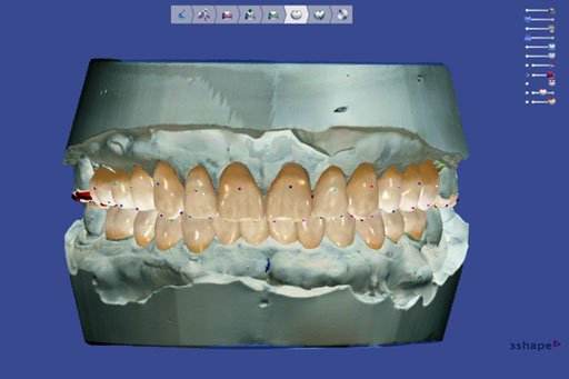 3D牙齒掃描模型